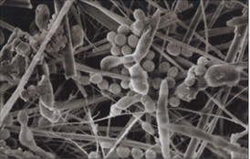 Filtro Semplice Vista al Microscopio